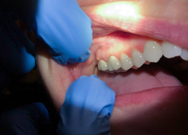 Trusted CA Emergency Dental Service Experts