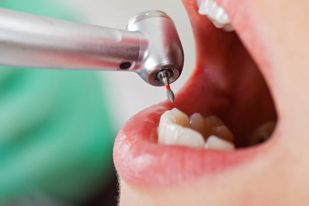 Best Walk-In Emergency Dental Services in Herald, CA